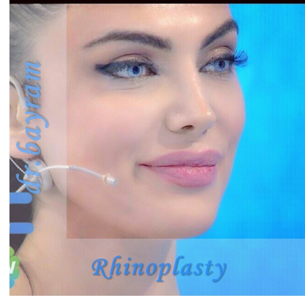 Rhinoplasty, Nose Surgery Results